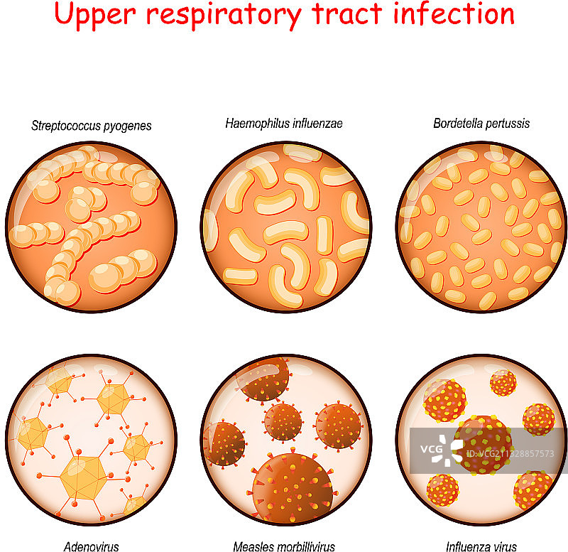 呼吸道感染细菌和病毒图片素材