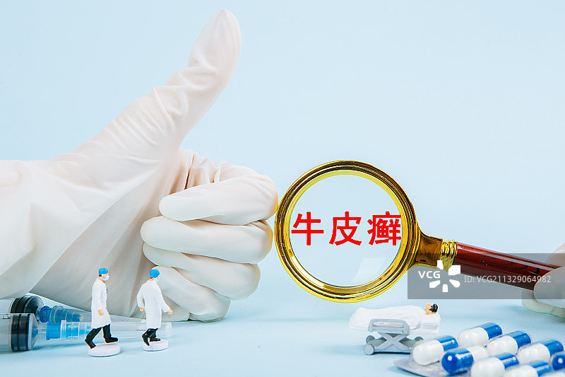 医疗概念：牛皮癣图片素材