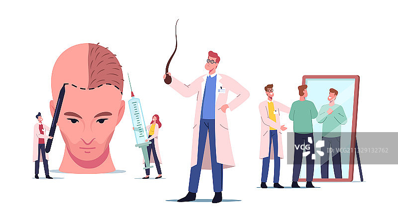 整形外科头发后退脱发问题图片素材