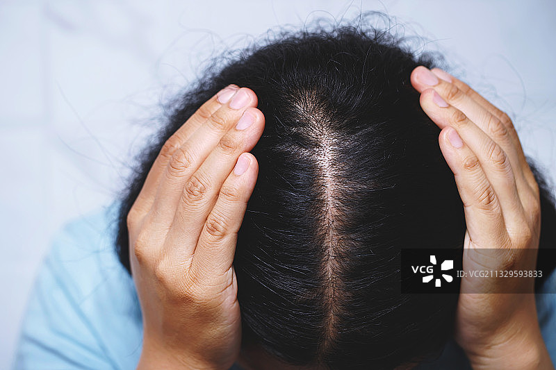 有脱发问题的女人特写图片素材