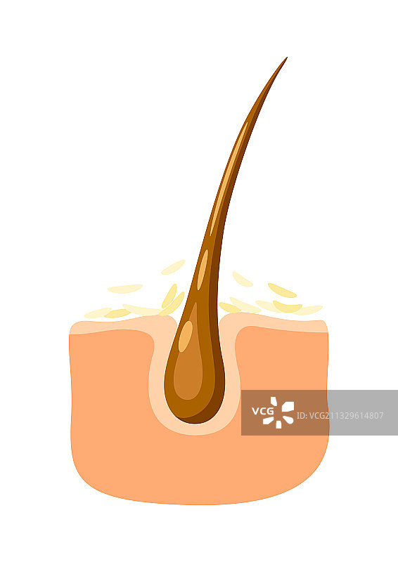 毛囊头皮屑图片素材