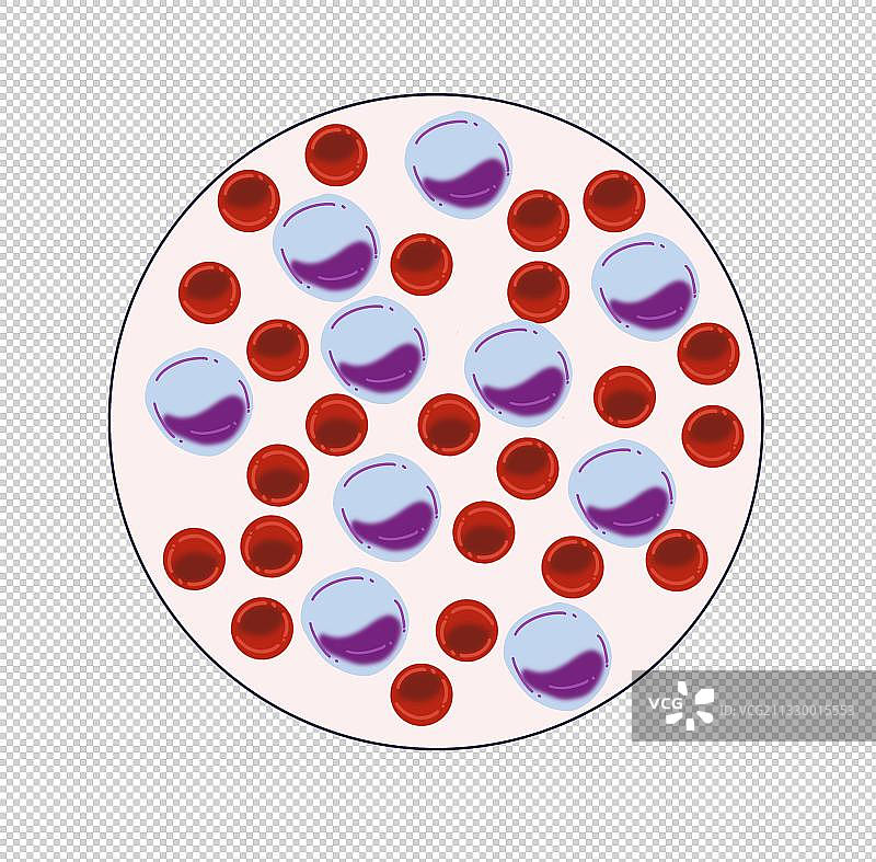 元素：白血病白细胞减少图片素材