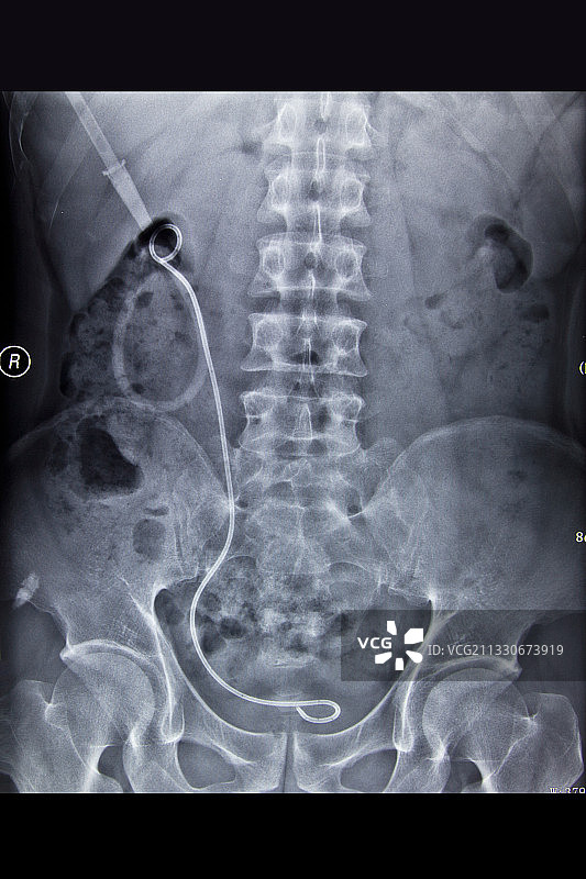 医学DR摄影X射线胶片影像图图片素材