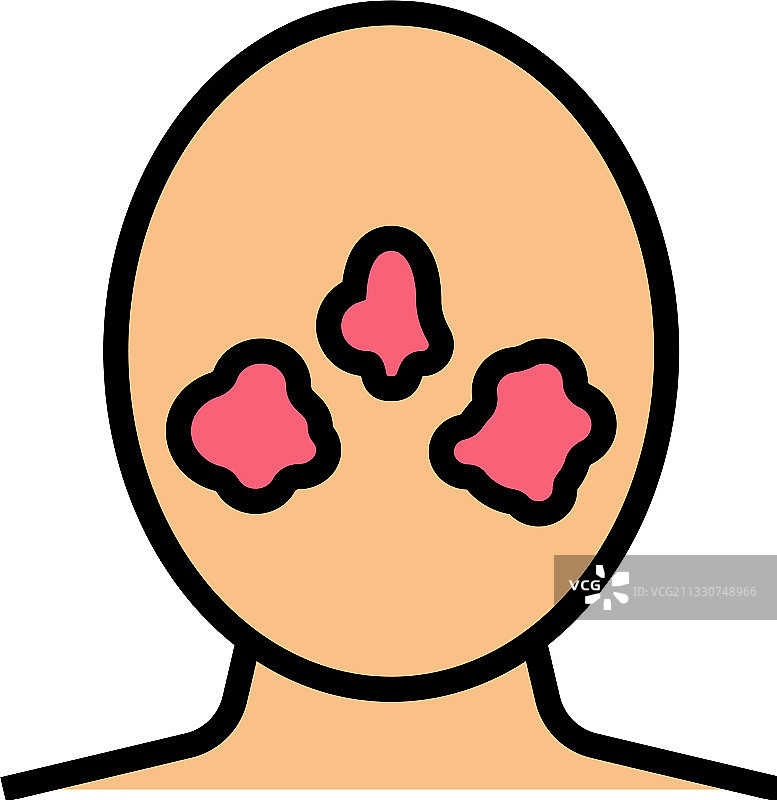 红斑痤疮皮肤病彩色图标图片素材