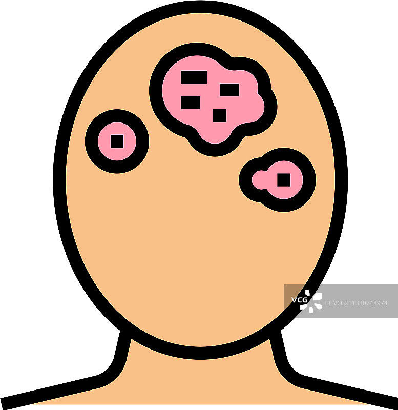 脂溢性皮炎皮肤病彩色图标图片素材