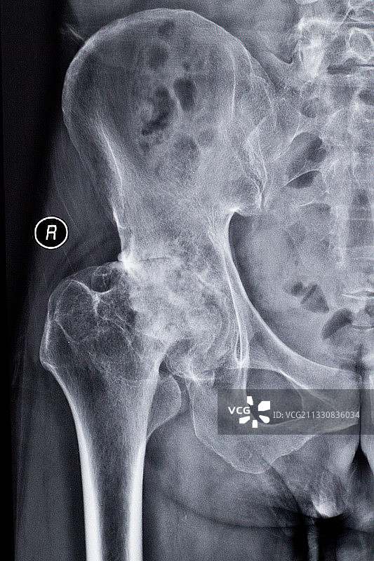 医学影像科的放射DR和CT和核磁共振摄影胶片图片素材