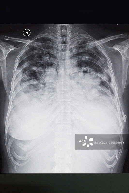 医学影像科的放射DR和CT和核磁共振摄影胶片图片素材