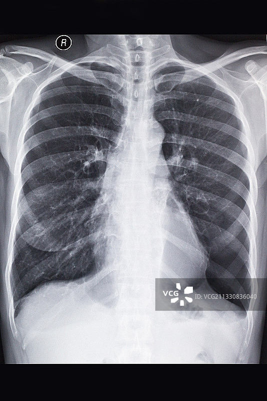 医学影像科的放射DR和CT和核磁共振摄影胶片图片素材