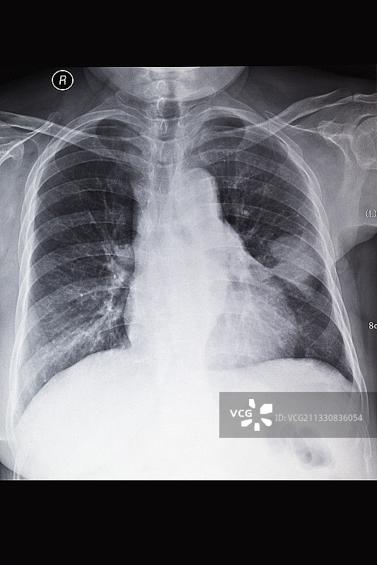 医学影像科的放射DR和CT和核磁共振摄影胶片图片素材