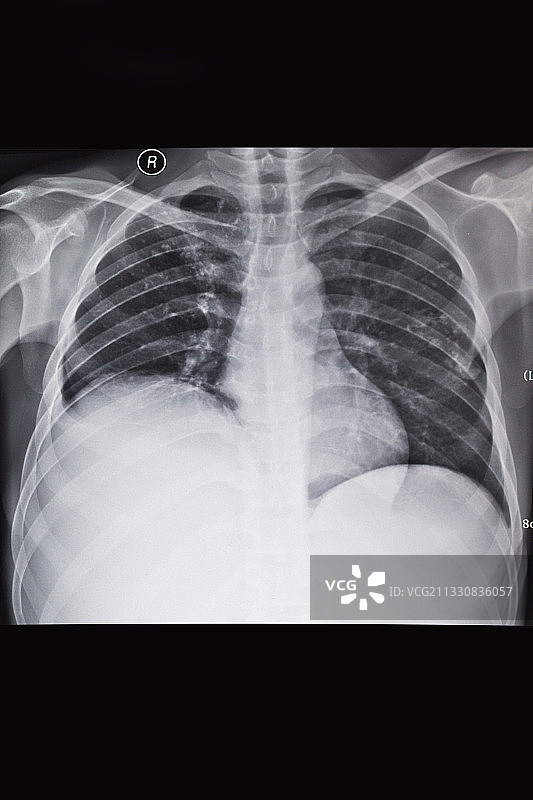 医学影像科的放射DR和CT和核磁共振摄影胶片图片素材
