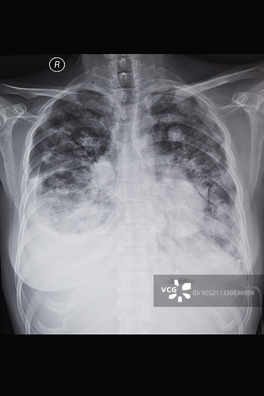 医学影像科的放射DR和CT和核磁共振摄影胶片图片素材