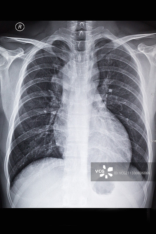 医学影像科的放射DR和CT和核磁共振摄影胶片图片素材