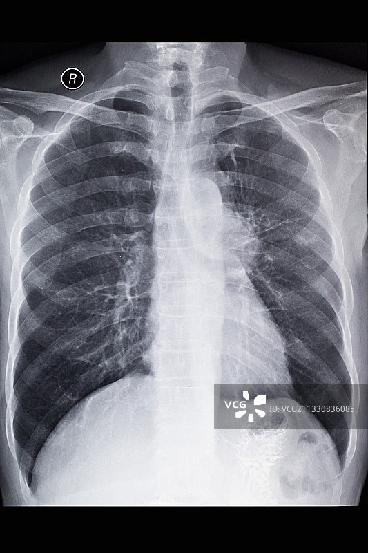 医学影像科的放射DR和CT和核磁共振摄影胶片图片素材