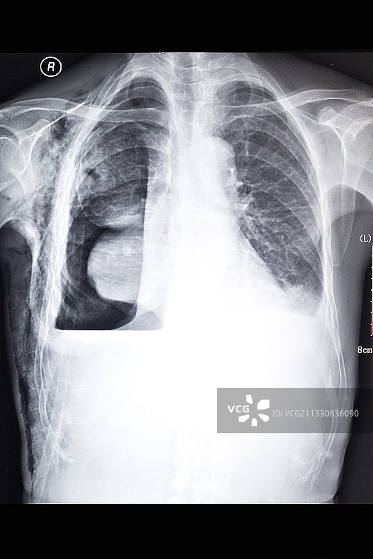 医学影像科的放射DR和CT和核磁共振摄影胶片图片素材