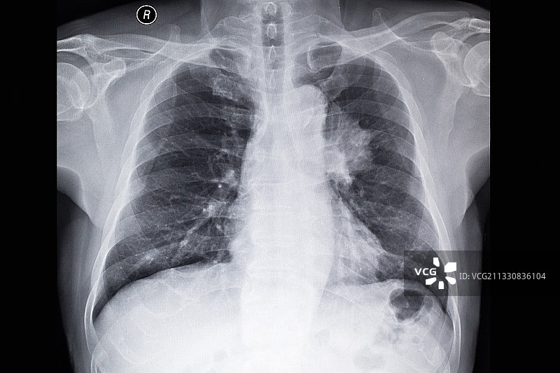 医学影像科的放射DR和CT和核磁共振摄影胶片图片素材
