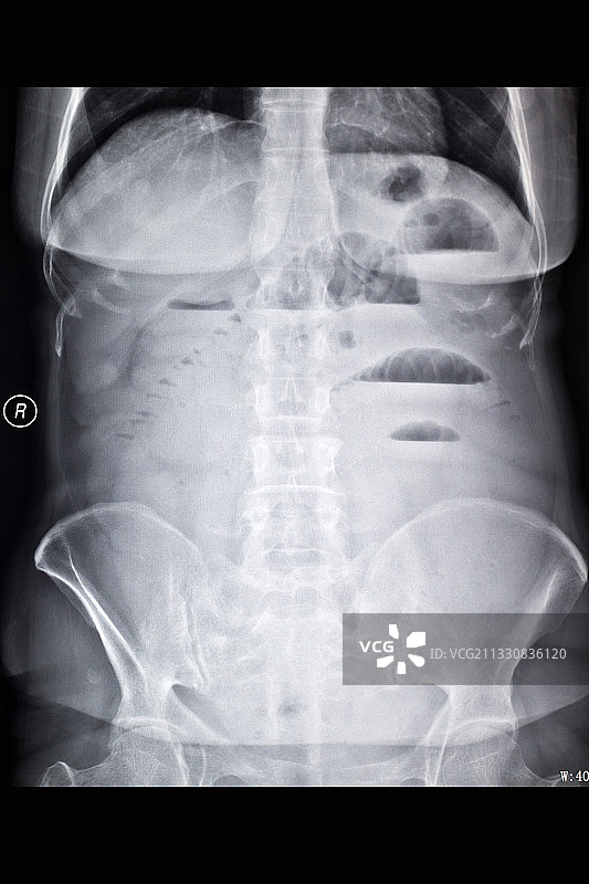 医学影像科的放射DR和CT和核磁共振摄影胶片图片素材