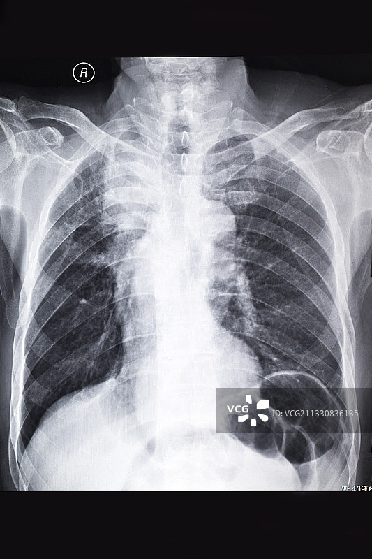 医学影像科的放射DR和CT和核磁共振摄影胶片图片素材
