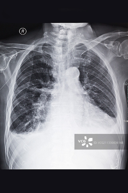 医学影像科的放射DR和CT和核磁共振摄影胶片图片素材