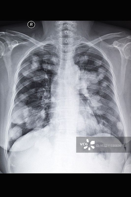 医学影像科的放射DR和CT和核磁共振摄影胶片图片素材