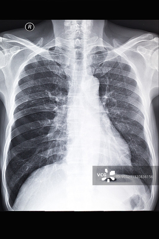 医学影像科的放射DR和CT和核磁共振摄影胶片图片素材