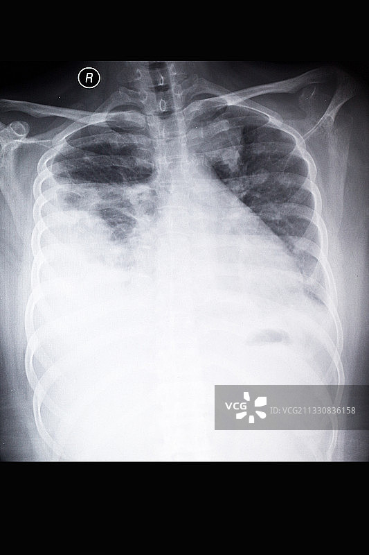 医学影像科的放射DR和CT和核磁共振摄影胶片图片素材