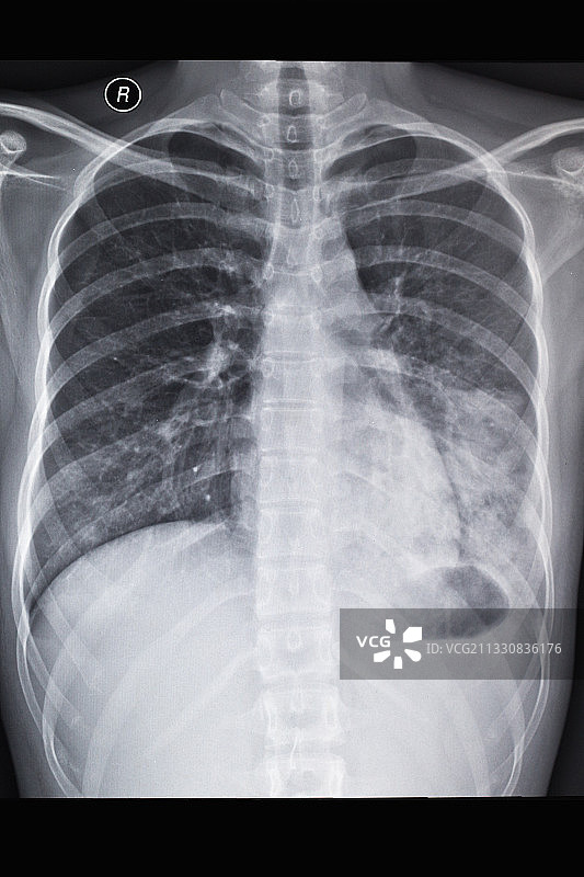 医学影像科的放射DR和CT和核磁共振摄影胶片图片素材