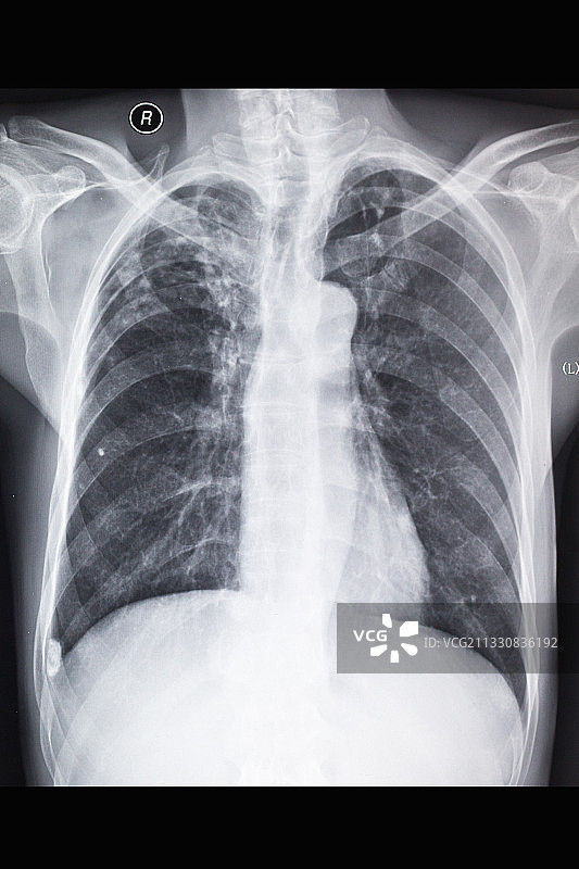 医学影像科的放射DR和CT和核磁共振摄影胶片图片素材