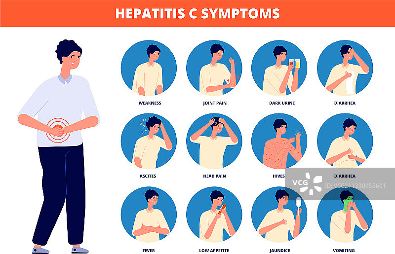 丙型肝炎症状：肝硬化治疗图片素材