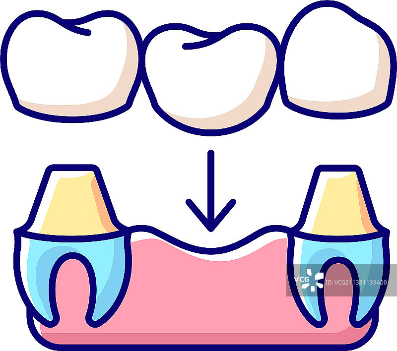 牙科修复体RGB颜色图标图片素材