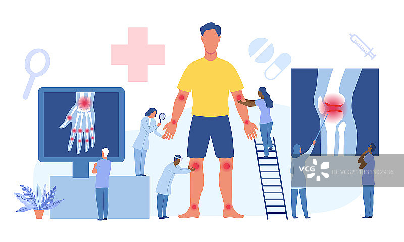 肘部、膝盖和踝关节炎概念图片素材