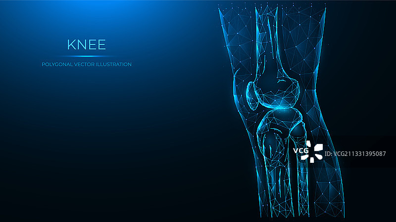 多边形膝关节侧视图图片素材
