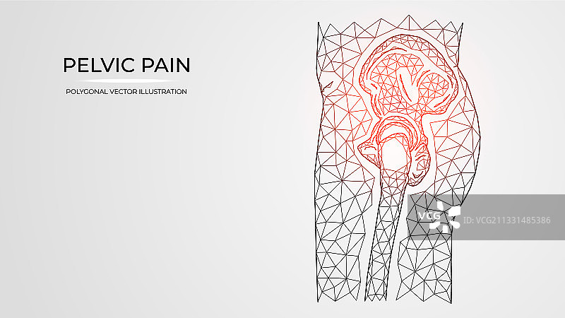 多边形疼痛炎症或受伤图片素材