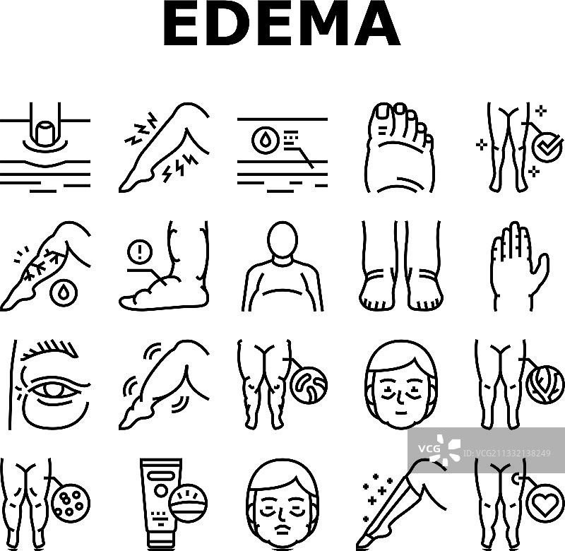 水肿疾病症状图标合集图片素材