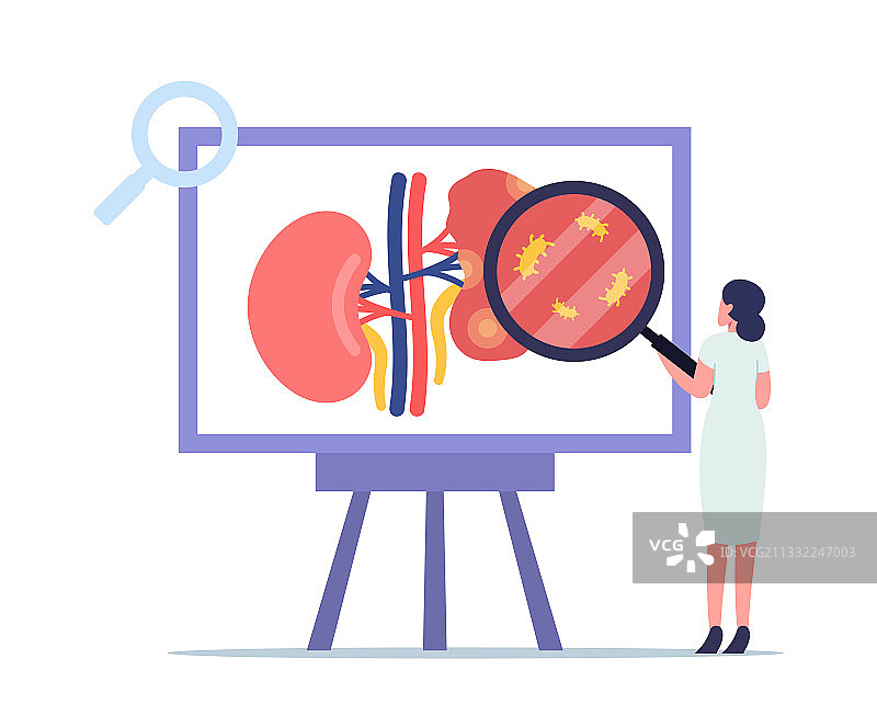 肾盂肾炎肾脏医疗保健概念图图片素材