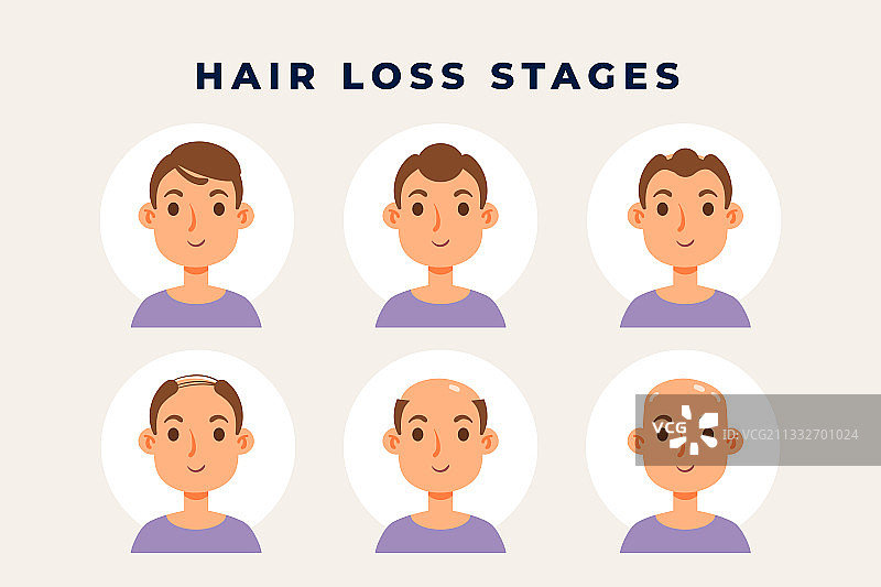 渐变式脱发方案图片素材