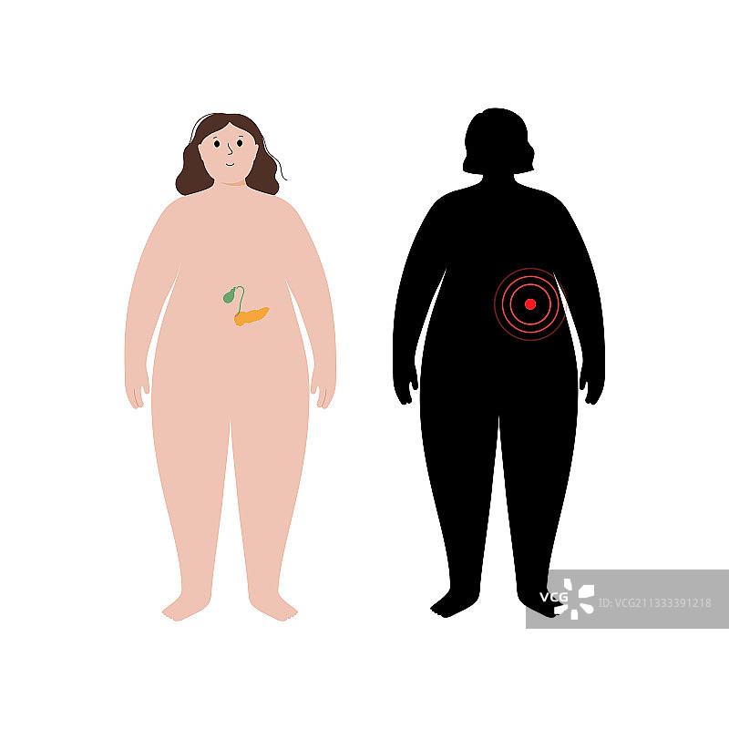 肥胖人体内的器官图片素材