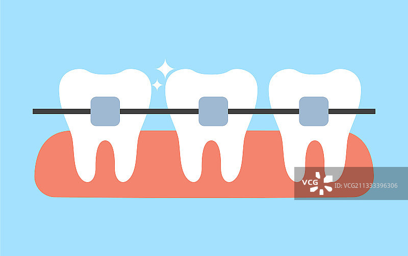 带有牙套的白色牙齿（扁平风格）图片素材