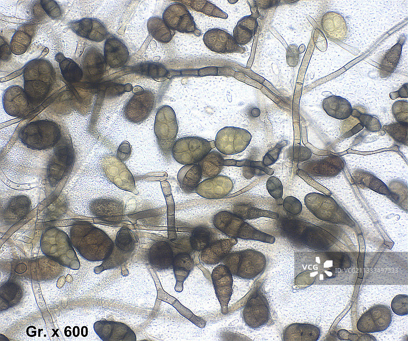 链格孢菌子囊菌丝体的显微照片图片素材