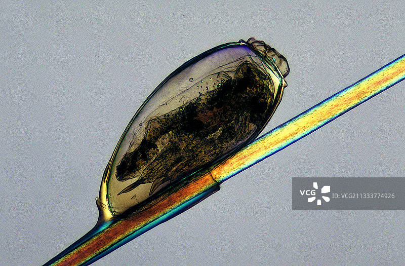 头发上头虱卵40倍放大图片素材