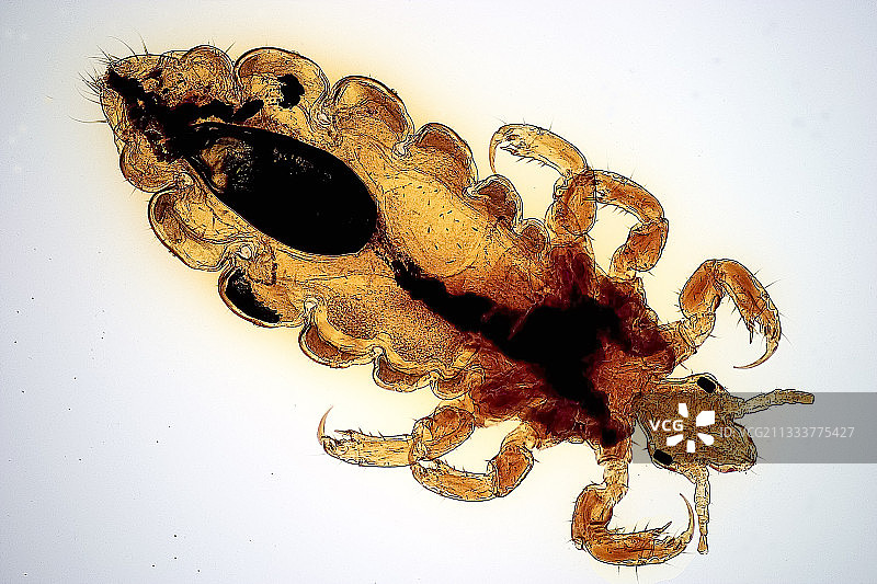 雌性头虱图片素材