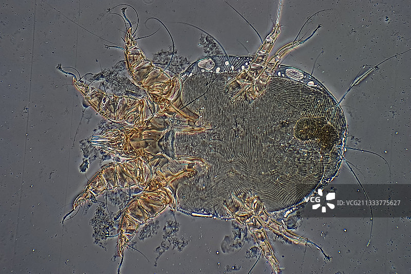 牛疥螨放大100倍图片素材