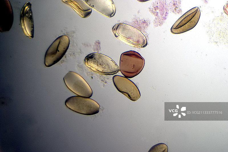 肝吸虫卵（100倍放大）图片素材