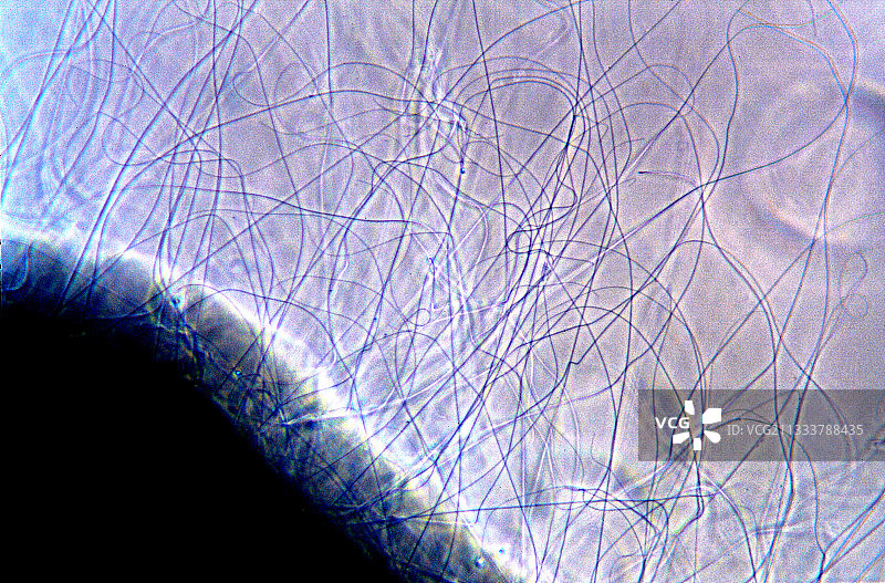埃斯塔蒂特紫蓝色刺胞水母喷射出的细丝图片素材