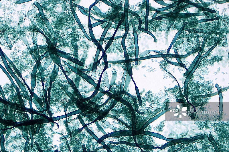 在青葱表皮上拍摄的毛霉菌细节图片素材