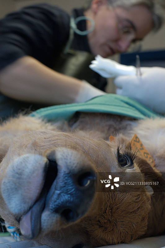 全麻下牛脐点手术图片素材