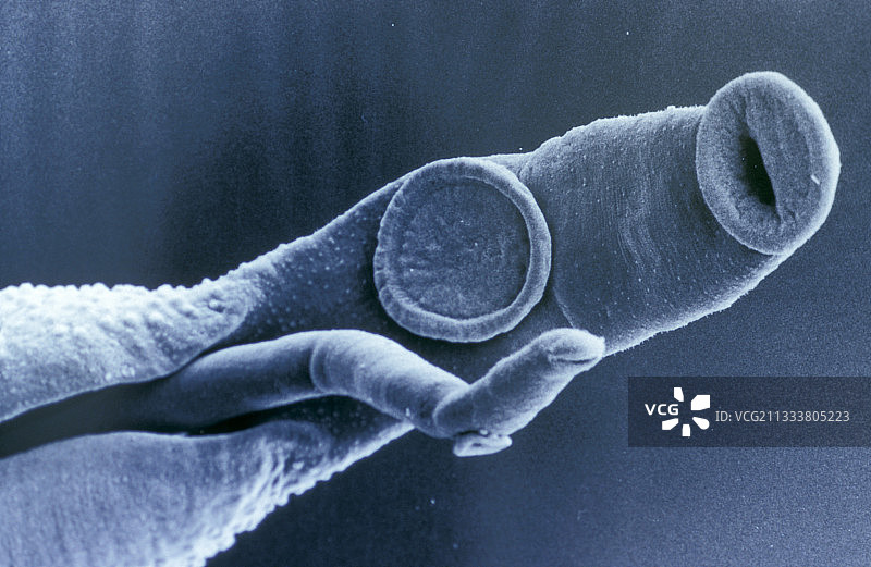 血吸虫是人类循环系统的寄生虫图片素材