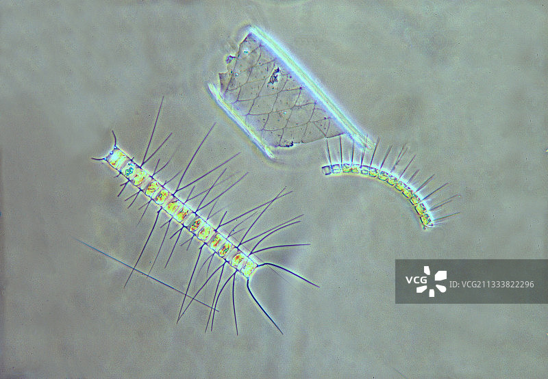 光学显微镜下的角毛藻图片素材