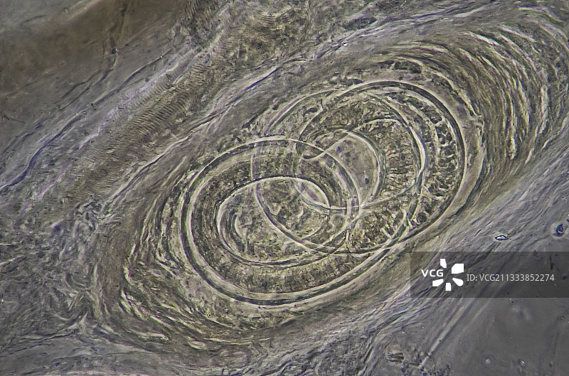 250倍光相衬放大图：囊肿图片素材