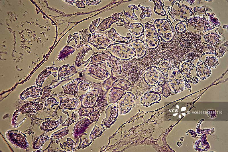 羊肝吸虫输卵管横截面图片素材
