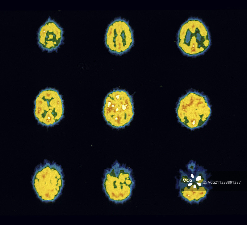 PET扫描图像和药物图片素材